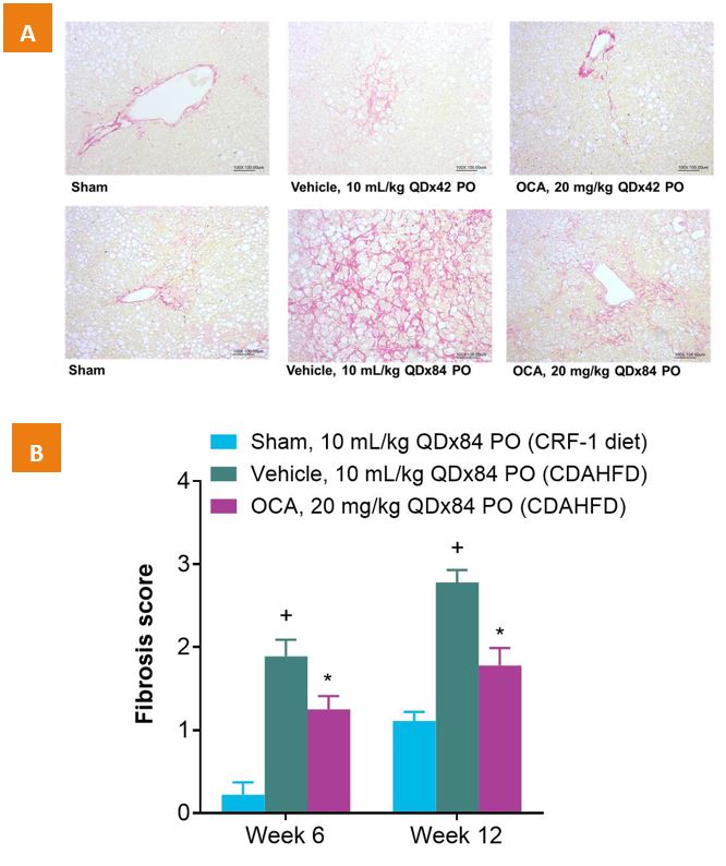 Demonstrated data for the CDAHFD Diet-Induced NASH Model in Humanized Liver Chimeric Mice